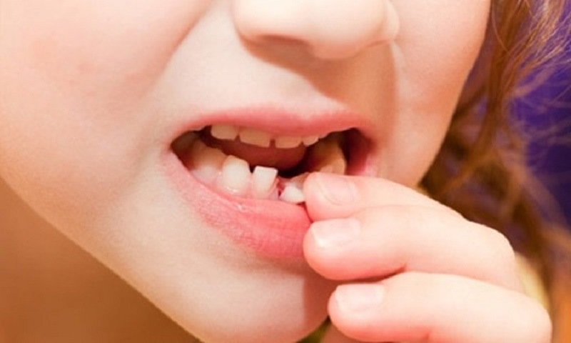 Khi thấy răng bé có dấu hiệu lung lay các bạn nên chủ động đưa bé tới viện khám và nhổ răng
