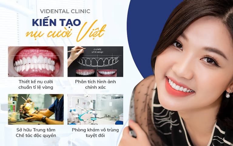 Trải nghiệm dịch vụ trồng răng Implant tại ViDental