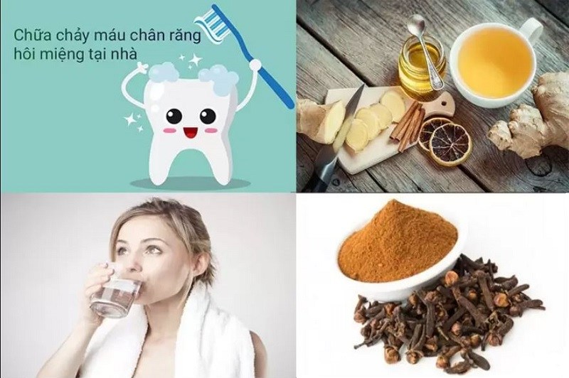 Một số biện pháp điều trị chảy máu chân răng tại nhà