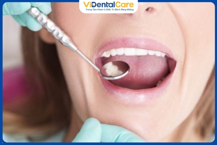 Khám răng và điều trị sâu răng tại cơ sở nha khoa uy tín là vô cùng cần thiết.