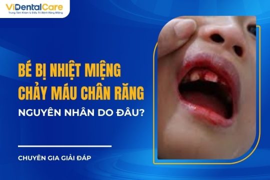 Bé Bị Nhiệt Miệng Chảy Máu Chân Răng Do Đâu? Cách Khắc Phục Hiệu Quả