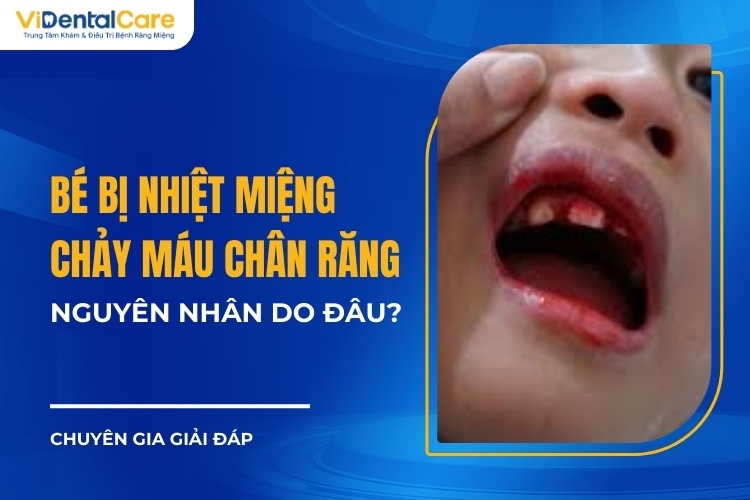 Phòng ngừa hôi miệng và chảy máu chân răng cho trẻ