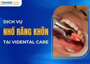 Dịch vụ Nhổ răng khôn