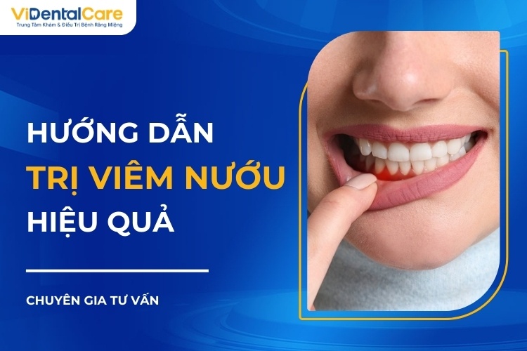 Điều trị viêm nướu hiệu quả