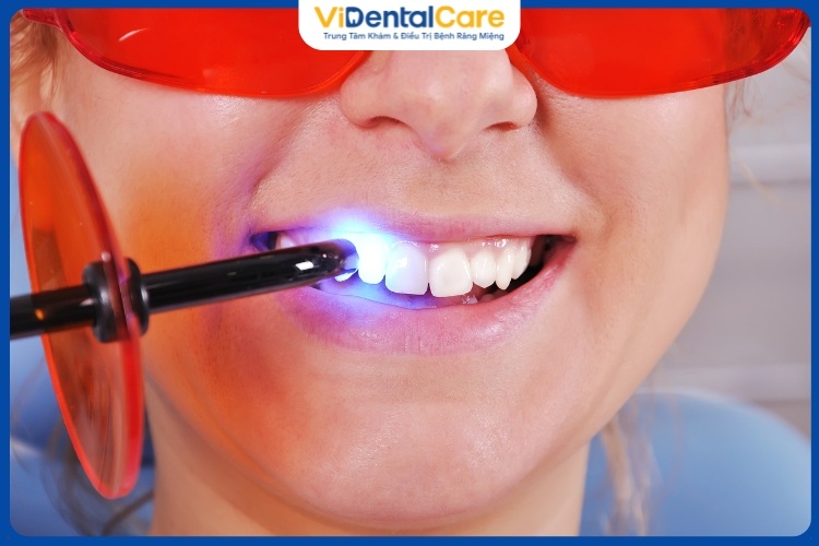 Hiệu quả trám răng gấp 3 lần với công nghệ laser