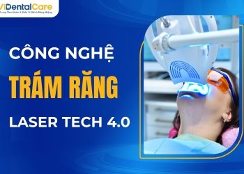 Trám Răng Hiện Đại với Công Nghệ Laser Tech 4.0 Tại ViDental Care