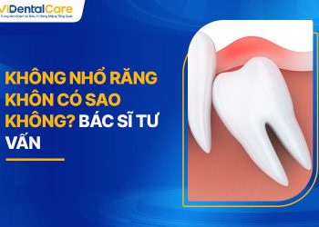 Không Nhổ Răng Khôn Có Sao Không? Bác Sĩ Tư Vấn