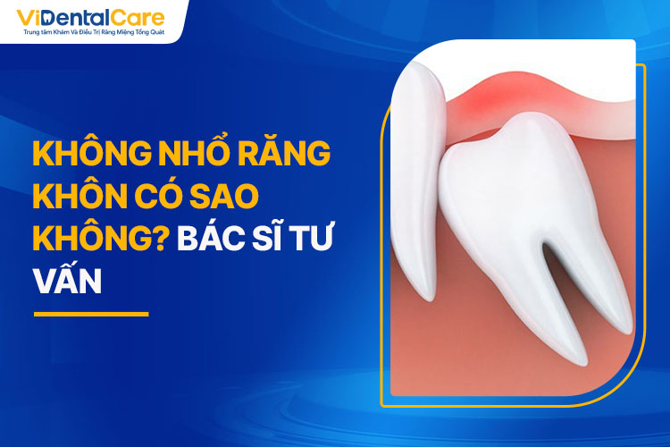 Không Nhổ Răng Khôn Có Sao Không? Bác Sĩ Tư Vấn