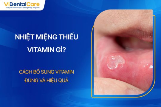 Nhiệt Miệng Thiếu Vitamin Gì? Cách Bổ Sung Đúng Và Hiệu Quả