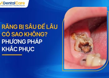 Răng Bị Sâu Để Lâu Có Sao Không? Phương Pháp Khắc Phục