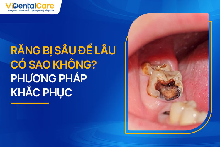 Răng số 8 bị sâu có sao không