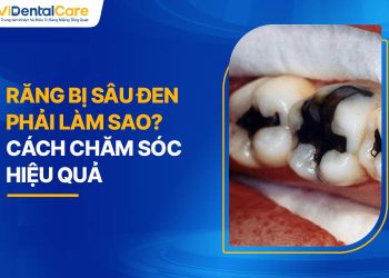 Răng Bị Sâu Đen Phải Làm Sao? Cách Chăm Sóc Hiệu Quả