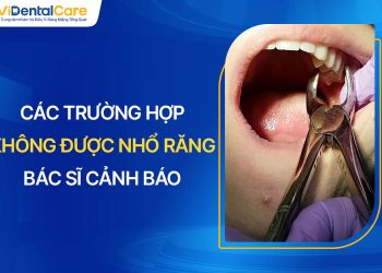 Các Trường Hợp Không Được Nhổ Răng Được Bác Sĩ Cảnh Báo