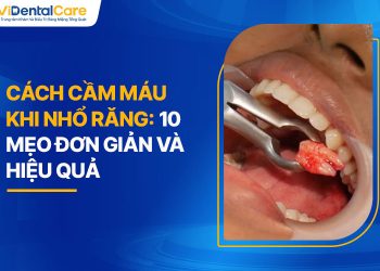 Cách Cầm Máu Khi Nhổ Răng: 10 Mẹo Đơn Giản Và Hiệu Quả