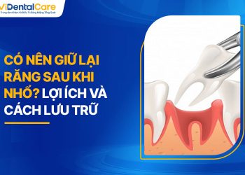 Có Nên Giữ Lại Răng Sau Khi Nhổ? Lợi Ích Và Cách Lưu Trữ