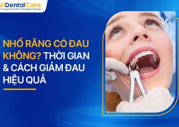 Nhổ Răng Có Đau Không? Thời Gian & Cách Giảm Đau Hiệu Quả