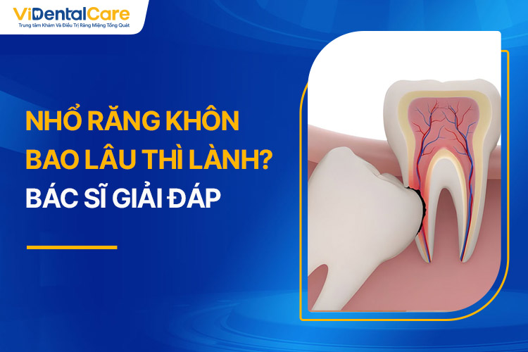 Nhổ Răng Khôn Bao Lâu Thì Lành? Bác Sĩ Giải Đáp