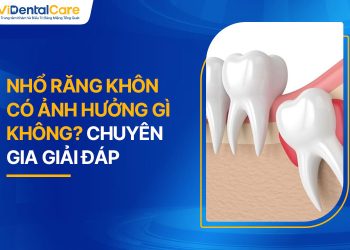 Nhổ Răng Khôn Có Ảnh Hưởng Gì Không? Chuyên Gia Giải Đáp