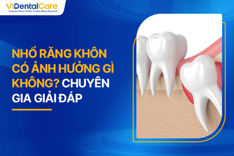 Nhổ Răng Khôn Có Ảnh Hưởng Gì Không? Chuyên Gia Giải Đáp