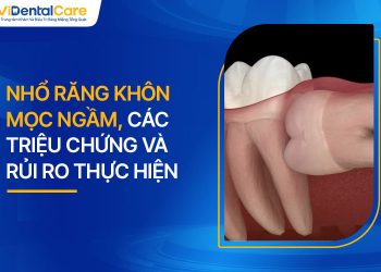 Nhổ Răng Khôn Mọc Ngầm, Các Triệu Chứng Và Rủi Ro Thực Hiện