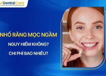 Nhổ Răng Mọc Ngầm Nguy Hiểm Không? Chi Phí Bao Nhiêu?