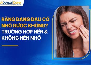 Răng Đang Đau Có Nhổ Được Không? Trường Hợp Nên Nhổ