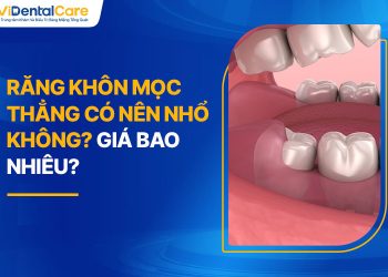 Răng Khôn Mọc Thẳng Có Nên Nhổ Không? Giá Bao Nhiêu?