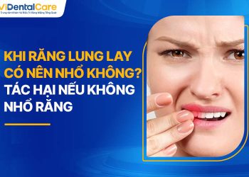 Khi Răng Lung Lay Có Nên Nhổ Không? Tác Hại Nếu Không Nhổ Răng