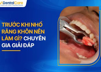 Trước Khi Nhổ Răng Khôn Nên Làm Gì? Chuyên Gia Giải Đáp