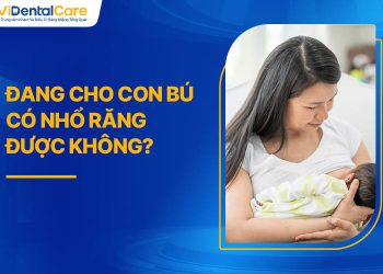 Đang Cho Con Bú Có Nhổ Răng Được Không? Điều Mẹ Cần Biết