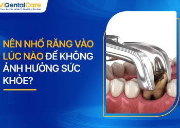 Nên Nhổ Răng Vào Lúc Nào Để Không Ảnh Hưởng Sức Khỏe?