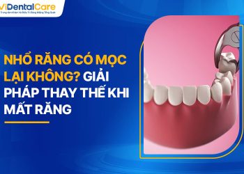 Nhổ Răng Có Mọc Lại Không? Giải Pháp Thay Thế Khi Mất Răng