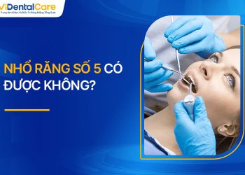 Nhổ Răng Số 5 Có Được Không? Mức Độ Nguy Hiểm Và Bảng Giá