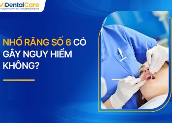 Nhổ Răng Số 6 Có Gây Nguy Hiểm Không? Chi Phí Bao Nhiêu?